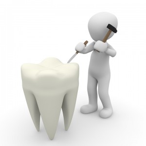 Jak odbudować uszkodzone szkliwo zębów? 